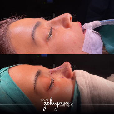 Slider image (4) Dr. Zeki Yasar Clinic